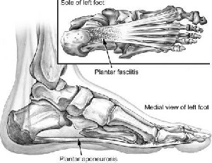 Plantarfaszie: Faszienball